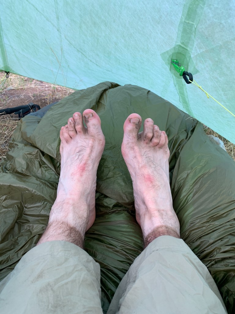 11 Dirty, grimy feet at the end of a long day in the Pyrenees
